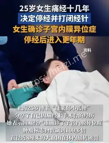 女性健康